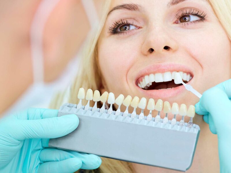 Estética dental en Ronda , clínica dental en Ronda. dentista en Ronda