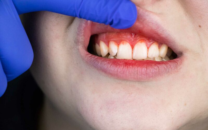 Periodoncia en Ronda , clínica dental en Ronda