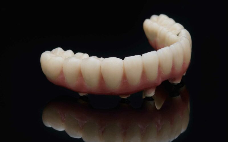 Prótesis dentales en Ronda, clínica dental en Ronda.