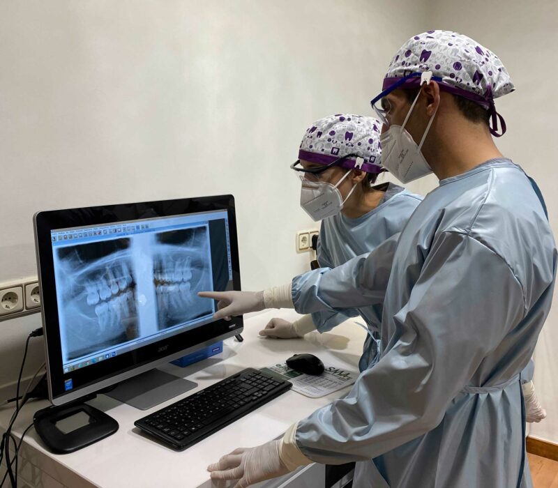 Odontología restauradora en Ronda , clínica dental en Ronda.