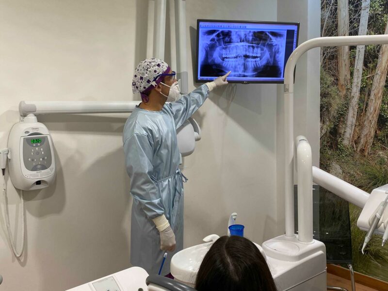 Prótesis dentales en Ronda, clínica dental en Ronda.